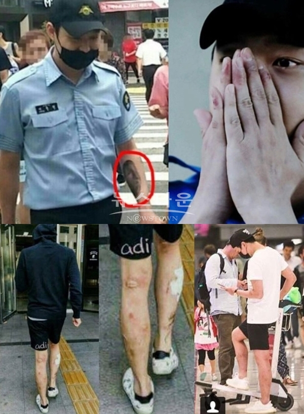 박유천 손 팔 다리 상처 (사진: 온라인 커뮤니티)