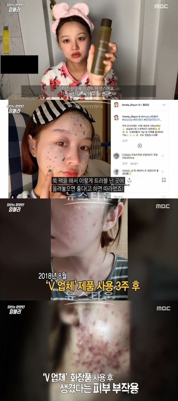 임블리 부작용 논란 (사진: MBC)