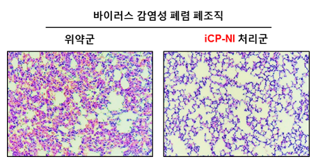 사진설명: RNA 바이러스 감염성 폐렴 동물모델의 폐 조직 (좌)이 염증으로 인해 부어올라 다공성 구조 (흰 공간)가 무너져 있음. 폐 다공성 구조가 무너지면 호흡능력이 떨어지고 심한 염증으로 폐 섬유化 및 출혈이 발생하여 사망에 이를 수 있음. 반면 iCP-NI 투여군 (우) 에서는 정상적인 다공성 폐 구조가 유지되고 염증이 관찰되지 않음
