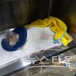카테터를 장착하고 방광세척