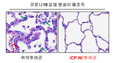 코로나19 감염 원숭이의 폐 조직파괴 치료효능: 위약투여군에서 면역세포 침윤 (녹색 화살표)과 출혈 (붉은색 화살표)이 보이는 것과 달리, iCP-NI 투여군에서는 조직파괴가 발견되지 않음